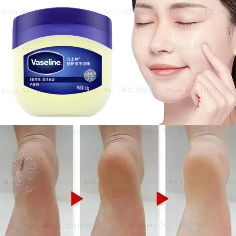 Vaseline Skin Rescue Cream