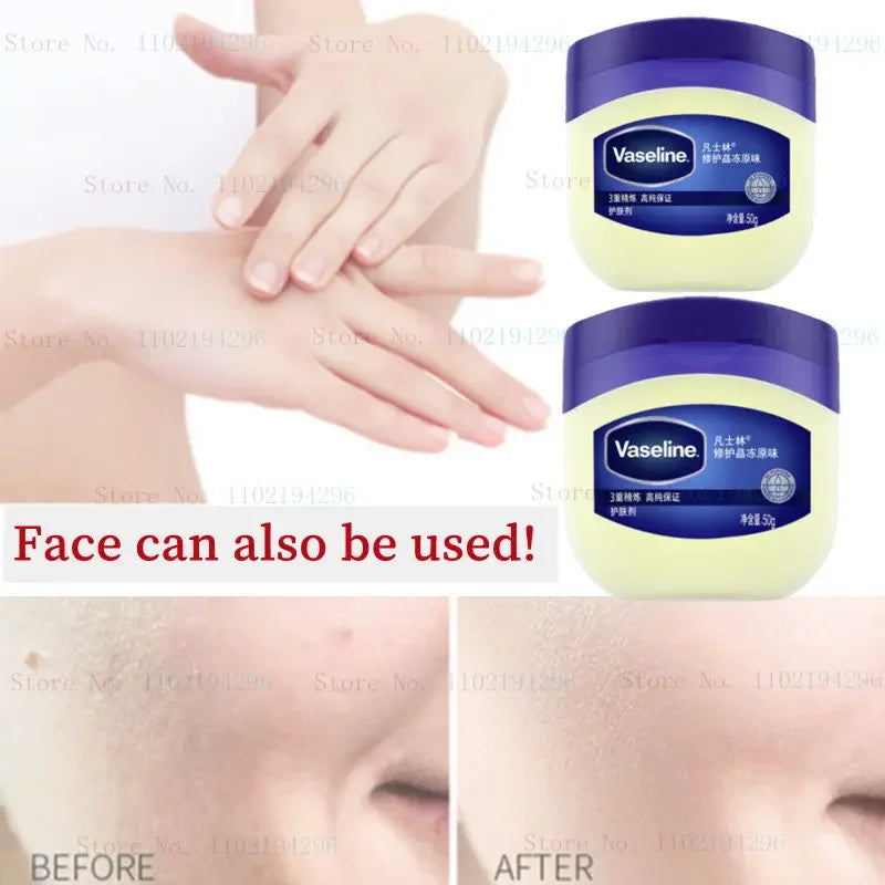 Vaseline Skin Rescue Cream